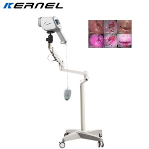 Colposcope numérique portable KN-2200A pour gynécologie et colposcopie vaginale avec caméra vidéo sur chariot - Product Image 5
