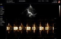 Échographe vétérinaire couleur Doppler 4D de 15,6 pouces, système d'échographie et accessoires d'échographie - Prix