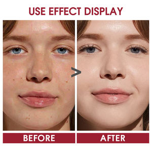 โทนเนอร์บำรุงผิวแบบไม่มีน้ำหอม ช่วยฟื้นฟูผิว ลดเลือนริ้วรอย ผสมไฮยาลูรอน วิตามินซี AHA และน้ำกุหลาบ โทนเนอร์<span class=keywords><strong>ส</strong></span><span class=keywords><strong>เปร</strong></span><span class=keywords><strong>ย์</strong></span><span class=keywords><strong>ส</strong></span>ำหรับใช้<span class=keywords><strong>ท</strong></span>ุกวัน - Product Image 5