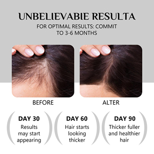 Champú y Acondicionador Activador de Folículos de Grado Clínico, Detiene la Caída del Cabello, Promueve el Crecimiento Visible, Cuidado del Cuero Cabelludo <span class=keywords><strong>con</strong></span> Tecnología Patentada Avanzada - Product Image 3