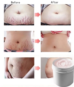 1kg cambodian da thảo dược thắt chặt căng đánh dấu loại bỏ kem cho bài mang thai, cơ thể chống căng đánh dấu Kem - Product Image 2