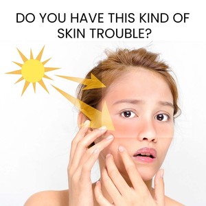 OEM Private Label Custom Care Acnes <span class=keywords><strong>crema</strong></span> <span class=keywords><strong>viso</strong></span> morbida <span class=keywords><strong>crema</strong></span> <span class=keywords><strong>solare</strong></span> biologica per il <span class=keywords><strong>viso</strong></span> - Product Image 6