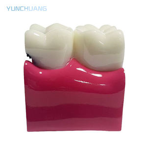 แบบจำลองการสอนทางทันตกรรมสำหรับชิ้นส่วนฟันผุ; แบบจำลองการสอนทางทันตกรรมสำหรับการสาธิต; แบบจำลองการเปรียบเทียบฟันผุ 6 เท่า - Product Image 2