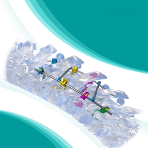 Fule 5.0mm Titanium Aanpasbaar Posterior Thoracolumbale Schroef-Stang Fixatie- en Fusiesysteem Klasse III met 5+ jaar garantie - Product Image 6