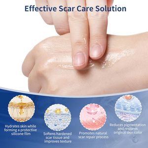Gel de Silicona de Grado Médico y Láminas Semisólidas para <span class=keywords><strong>Cicatrices</strong></span> en Rostro, Cuerpo, Piernas, Brazos y <span class=keywords><strong>Cicatrices</strong></span> de Cesárea - Product Image 5