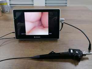 Endoscopio veterinario portatile Video flessibile prezzo broncoscopio - Product Image 5