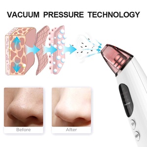 Produits Populaires 2025 – Appareil d'aspiration anti-points noirs OEM pour usage domestique et soins de beauté - Product Image 5