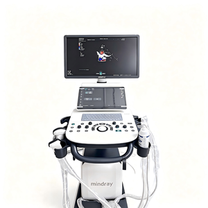 Ecógrafo Doppler Color Mindray Consona N5S con Elastografía y Auto IMT para Diagnóstico Multiespecializado - Product Image 1