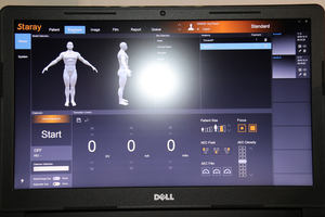 Pas cher prix FPD 17*17 ''détecteur à écran plat à rayons <span class=keywords><strong>X</strong></span> numérique pour vétérinaire et humain CSI pour le logiciel humain et vétérinaire - Product Image 5