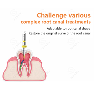 Fils endodontiques rotatifs flexibles en NiTi pour canaux radiculaires, système complet d'instruments endodontiques compatible avec le moteur endodontique dentaire - Product Image 2
