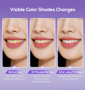 Hasil sempurna memutihkan instan gigi ungu koreksi warna pemutih Tech Glorysmile V34 strip pemutih gigi - Product Image 6