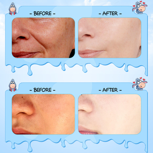 OEM ZOZU Marque privée Niacinamide Produits de soins de la peau <span class=keywords><strong>Lait</strong></span> <span class=keywords><strong>d</strong></span>'ânesse Doux Nourrissant Apaisant Hydratant Blanchissant Crème pour le visage - Product Image 5