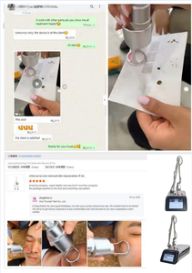 Machine de découpe laser fractionnée au CO2 portable pour la resurfaçage cutané, le renouvellement de la peau et la récupération des dommages solaires - Product Image 6