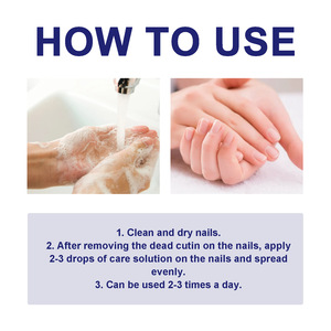 South Moon soin des pieds de haute qualité Anti-infectieux réparation fongique doux épaississement des <span class=keywords><strong>ongles</strong></span> nettoyage liquide de soin des <span class=keywords><strong>ongles</strong></span> - Product Image 3