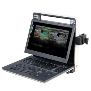 เครื่องอัลตราซาวด์สีพกพา SIUI Apogee C2 พร้อมระบบ Strain Elastography สำหรับงานดูแลสัตว์หลายสายพันธุ์ - Product Image 2