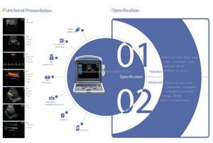 Aplicación clínica Led médica Ecografía Doppler de color portátil B/W Escáner de ultrasonido Máquina de ultrasonido - Product Image 6