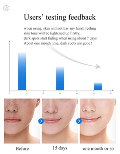 Private label di qualità <span class=keywords><strong>molto</strong></span> buona formula sicura anti cloasma lentiggine melasma macchie scure <span class=keywords><strong>crema</strong></span> sbiancante - Product Image 6
