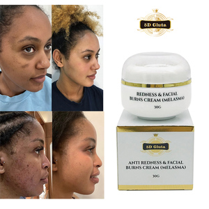 Crema Sbiancante 5D Gluta per Rimozione Melasma, Trattamento per Rossori e Scottature Facciali, Rimozione Macchie Scure, Anti-Macchie, Schiarimento Lentiggini - Product Image 2
