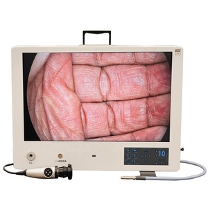 Endoscopio rígido a precio <span class=keywords><strong>de</strong></span> fábrica con cámara FHD para uso veterinario en clínicas <span class=keywords><strong>de</strong></span> mascotas - Product Image 4