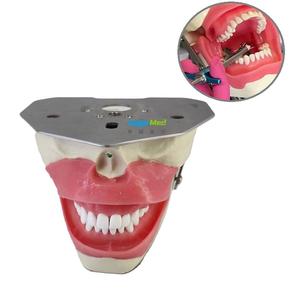 Simulator Ilmu Kedokteran Gigi, Manikin Pelatih Anestesi Oral, Model Anestesi Konduksi Gigi - Product Image 3