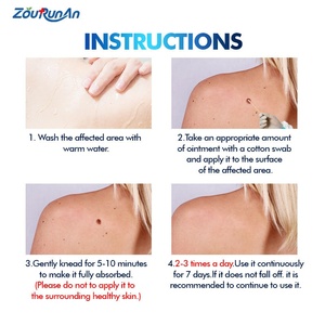 ZouRunAn Skin Herbal Extract <strong>Genital</strong> <strong>Warts</strong> Removal Ointment <strong>Genital</strong> <strong>Wart</strong> Relief Cream 6 Months Shelf Life - Product Image 4