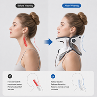 Appareil de traction cervicale électrique certifié CE BOAN, batterie intégrée, classe I, matériau plastique, 1 an de garantie