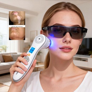 ABD Sertifikalı Excimer Lazer 308nm UV Fototerapi Vitiligo Sedef Hastalığı UV Lambası Fototerapi Yüz Vitiligo Tedavisi - Product Image 1