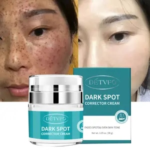 Effective Freckle Remove Anti Aging Facial Lotion Melasma Dark Spot Removing Corrector Whitening Face Cream