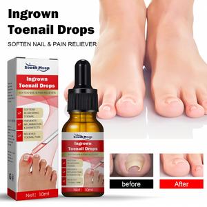 Logo personnalisé South Moon Gel réparateur pour ongles incarnés gouttes adoucissantes pour ongles et analgésiques sérum de traitement des ongles - Product Image 3