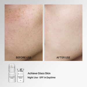 Kit <span class=keywords><strong>de</strong></span> sérum éclaircissant personnalisé OEM ODM pour <span class=keywords><strong>l</strong></span>'élimination des taches brunes par micro-infusion, traitement <span class=keywords><strong>de</strong></span> la peau pour une peau éclatante, ensemble <span class=keywords><strong>de</strong></span> soins <span class=keywords><strong>de</strong></span> la peau, marque privée - Product Image 5