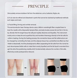 Lifting facial con láser endo de 1470nm, tensado de cuello con láser endo dual de 980nm, máquina de terapia láser de diodo Body Tite mínimamente invasiva. - Product Image 3