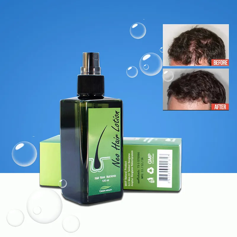 Neo Haarlotion 100% Hoogwaardige Hoofdhuidbehandeling Stop Haaruitvalwortel Voor Vrouw Man Haarlotion