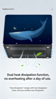 Carcasa Personalizada para Laptop con Diseño de Moda para MateBook D14/D15/D16/XPro 13.9/14.2 Honor MagicBook 14/15/Pro X14/X15 Business Daily
