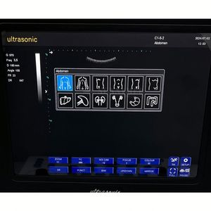 Système d'échographie diagnostique SY-AX50-1 Machine d'écho à ultrasons Doppler Scanner à ultrasons portable pour vétérinaire et humain - Product Image 3