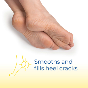 <span class=keywords><strong>Crema</strong></span> para el cuidado de los pies, productos para el cuidado de los pies, bálsamo reparador de talón agrietado con <span class=keywords><strong>25</strong></span>% de <span class=keywords><strong>urea</strong></span> para pies secos y agrietados - Product Image 2