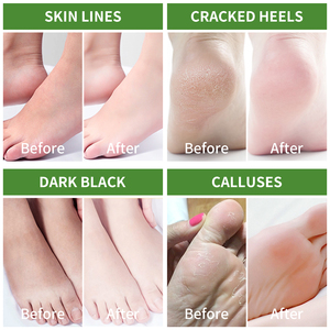Máscara Exfoliante para <span class=keywords><strong>pies</strong></span>, <span class=keywords><strong>mascarilla</strong></span> exfoliante de marca privada, coreana, para reparación de talón, Spa - Product Image 2