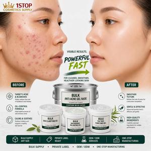 Emulsión Hidratante para la Piel Isov Beauty Salon, Crema en Gel de Centella, Desmaquillante, Loción Tonificante para Limpiar Poros y Puntos Negros - Product Image 1