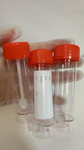 स्पुटम नमूना कंटेनर स्टेरिल 30 मिली मल मल कंटेनर मूत्र के साथ कंटेनर मूत्र कंटेनर - Product Image 3