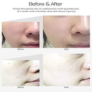 Private label OEM caviale di mare profondo Anti-rughe Lifting sbiancante viso idratante siero - Product Image 6