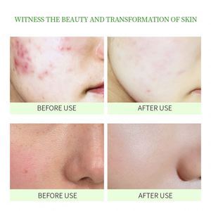 BIOAQUA ODM <span class=keywords><strong>Gel</strong></span> d'<span class=keywords><strong>aloe</strong></span> <span class=keywords><strong>vera</strong></span>, fabricant de masques de beauté, masques faciaux hydratants, soins de <span class=keywords><strong>la</strong></span> peau, masque facial en feuille - Product Image 4