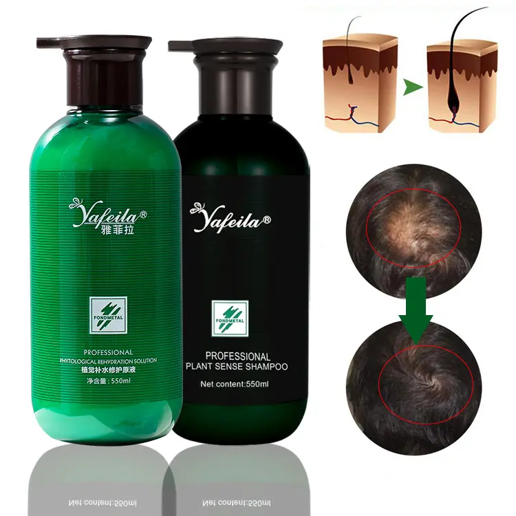 Extrato de gengibre de ervas anti-queda de cabelo shampoo e pão de fundo à base de plantas, produtos anti-caspa para spa