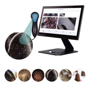 New Technology <strong>HD</strong> Skin <strong>Anal</strong>;yzer Hair Analysis Machine Scalp Camera Hair Analyzer for Hair Salon and Beauty Clinic - Product Image 2