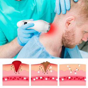 कारखाने पशु चिकित्सा घोड़े और कुत्ते दर्द राहत उपकरण पालतू घाव भरने के लिए लेजर भौतिक चिकित्सा मशीन - Product Image 5