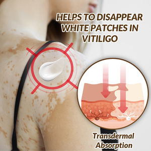 Crème Pommade Soulageant les Taches Blanches pour le Corps Traitement aux Plantes pour la Peau Crème pour le <span class=keywords><strong>Vitiligo</strong></span> Plâtre Chinois Ciblé pour l'Élimination des Taches - Product Image 5