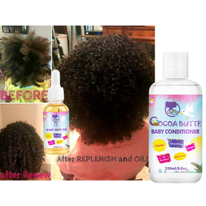 Curlymommy-productos para el crecimiento del cabello para niños, productos naturales para el cuero cabelludo seco, envío rápido - Product Image 6