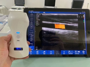 Ecógrafo Doppler Portátil Inalámbrico Wifi, Máquina <span class=keywords><strong>de</strong></span> Ultrasonido Doppler Inalámbrica, Sonda Médica Veterinaria <span class=keywords><strong>de</strong></span> 7.53.50MHz - Product Image 4