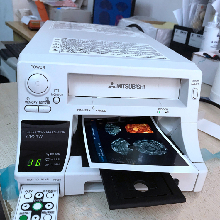 Papel de Impresora térmica a color de alta densidad Mitsubishi Ck30S para impresora de video ultrasonido