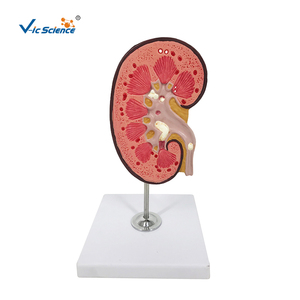 PVC anatomico pietra renale modello di anatomia per la scienza medica di educazione - Product Image 1