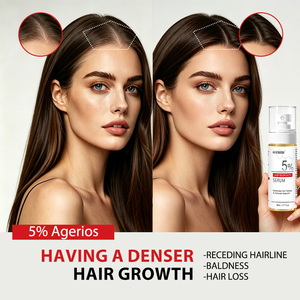 Spray para la Caída del Cabello para Hombres y Mujeres, <span class=keywords><strong>Alopecia</strong></span> Androgénica, Inhibidor de Androgenas al 5%, Bruma Capilar con Jengibre y Menta, Estimula el Crecimiento - Product Image 3