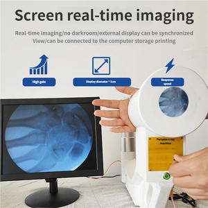 מערכת רנטגן ניידת כף-יד מתקדמת של מערכת X-זרוע לניתוחים וטרינריים - Product Image 2